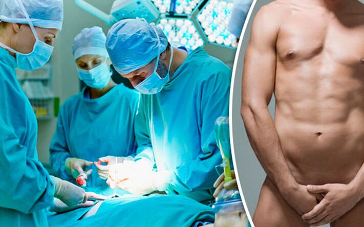 Increased penis surgery